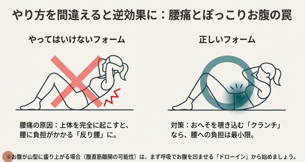 腰痛の原因となる反り腰を誘発する間違った腹筋フォーム（シットアップ）と、腰への負担が少ない正しいフォーム（クランチ）の比較図。